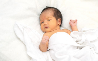How to Prevent Jaundice in Newborns (Hyperbilirubinemia)
