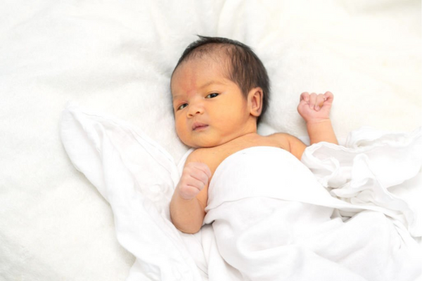 How to Prevent Jaundice in Newborns (Hyperbilirubinemia)