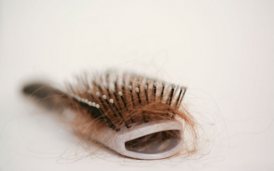 All You Need to Know About Hair Loss