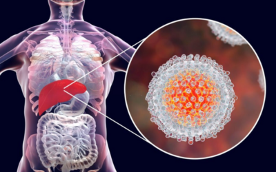 Pathogenicity and Epidemiology of Hepatitis C Virus