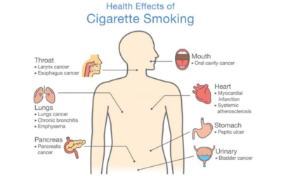 Effects of Cigarette Smoking on One’s Health
