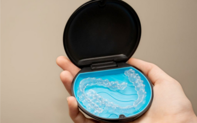 Top Benefits You Can Avail by Opting Invisalign