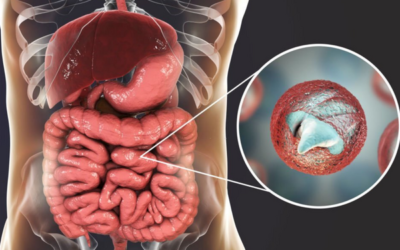 The Myth about Intestinal Parasites