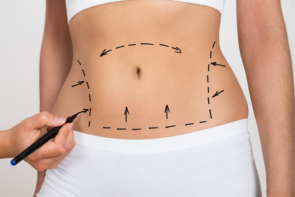 How Is The Recovery From Liposuction How Is The Recovery From Liposuction?