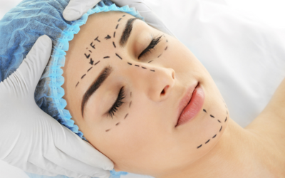 3 Common types of Cosmetic Plastic Surgery