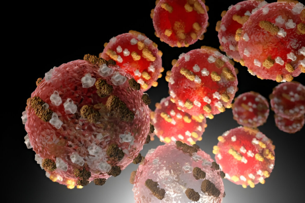 Texas Measles Outbreak 2025 Largest Surge in Decades Hits Unvaccinated Communities
